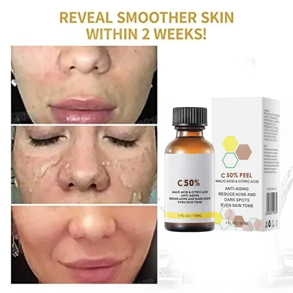 

Salicylic Acid Face Facial Peel Neutraliser Face Deep At Home Chemical Peel Exfoliate Refine skin care serum NEW