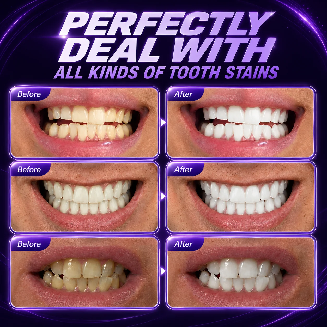 1/7 pares de tiras blanqueador - Teeth Whitening Strips reseña y precio