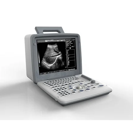 Special Design XF300 Full Digital LED Machine Pocket Portable Laptop Ultrasound Prices