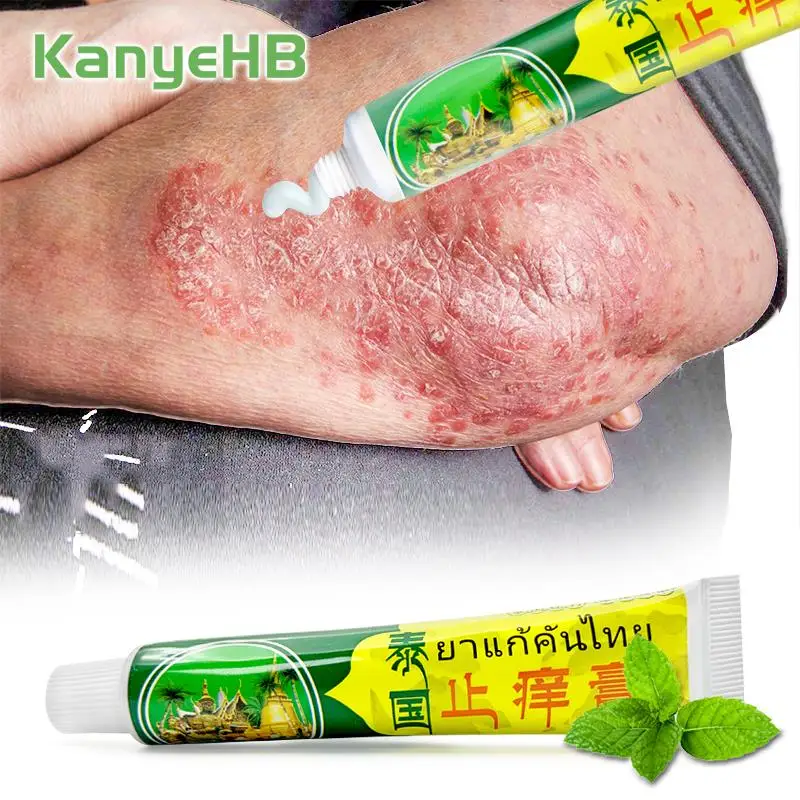

1pcs Thailand Skin Treatment Ointment Psoriasis Cream Anti-itch Repair Damaged Skin Mint Cooling Cream Dermatitis Eczema S074
