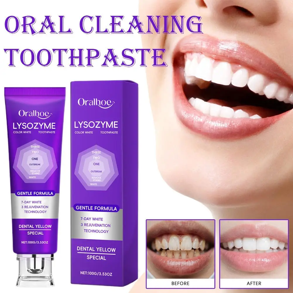 

Purple Whitening Toothpaste Remove Plaque Stains Tartar Clean Breath Stain-Removing Toothpaste Prevent Decay Fresh Hygiene P2J3