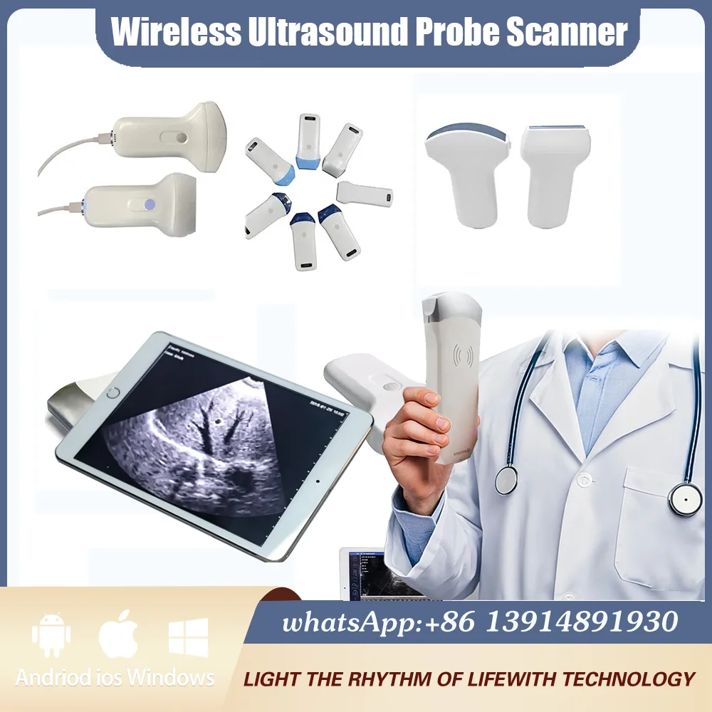 Animal Multi-System WIFI Ultrasound Probe Portable Doppler Imaging Device Sonostar Brand Complete With Free Protective Suitcase