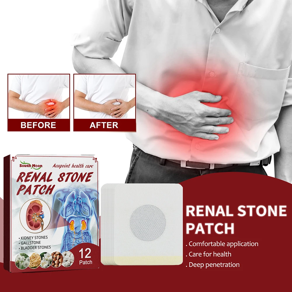 

Kidney Pain Relief Patch Renal Stone Patch Treat Gallstones Herbaceous Extract Mild Comfortable Urolithiasis Pain Relief Sticker