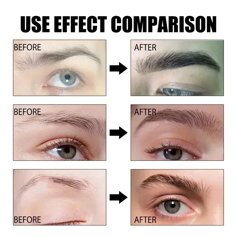 Fast Eyebrow Growth Serum 7 Day Eyelash Hair Growth Anti Hairs Loss Product Prevent Baldness Fuller Thicker Lengthening Eyebrow