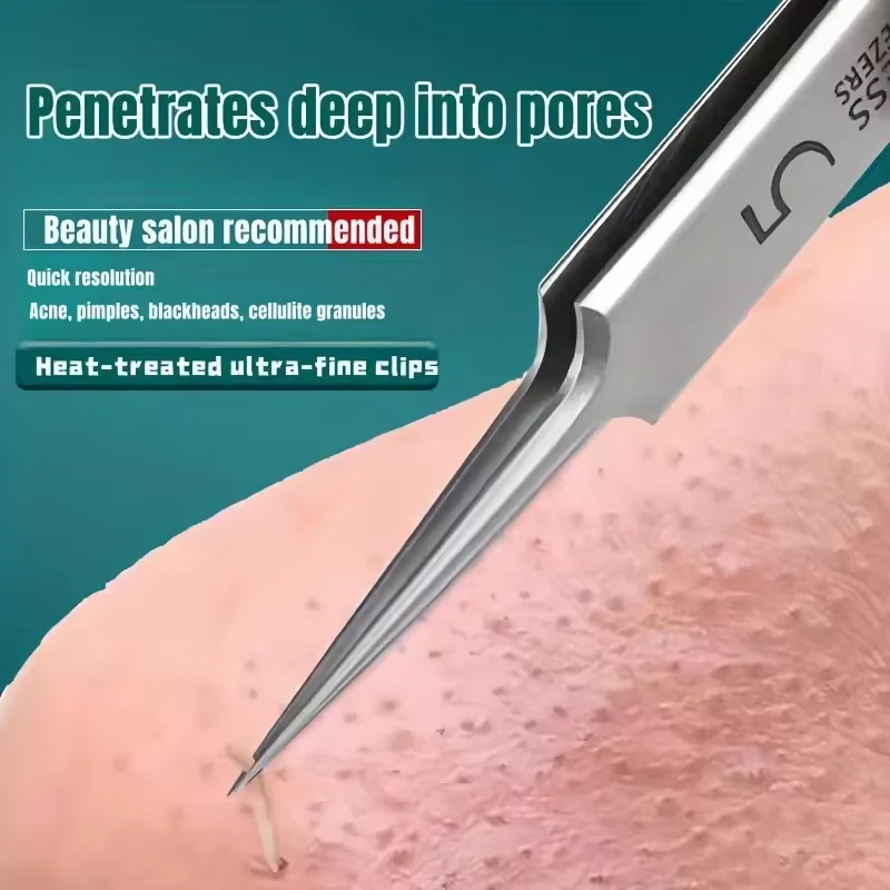 Pickel-Extraktionswerkzeuge, Mitesser-Entferner, Pickel-Popper, Akne-Entfernungsset, rissfreie Behandlung, Whitehead Popping, Mitesser-Pinzette