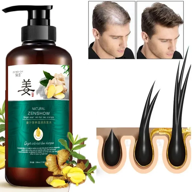 Hair Care Ginger Shampoo Natural Anti Hair Loss Fast Growing Prevent Baldness Repair Scalp Frizzy Damaged