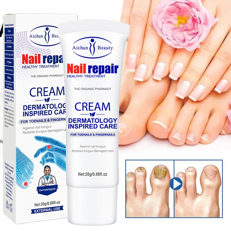 Extra Strong Nail Repair Cream Anti Infection Nail Fungus Treatments Feet Onychomycosis Repair Product Unisex Feet Care 20g