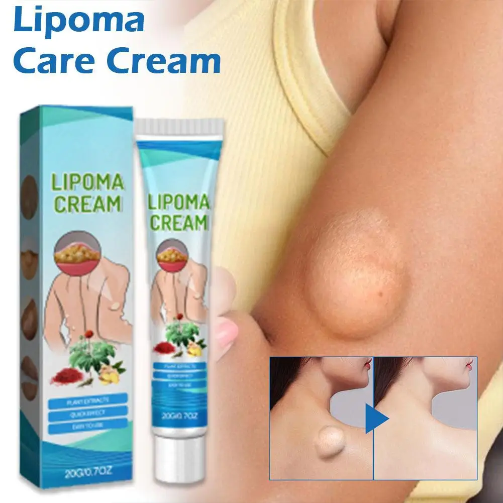 Natural Plant Lipoma Removal Cream Extract Treatments Plaster Removes Lipomas Fibroids Subcutaneous Lumps Pain Relief Skin Care