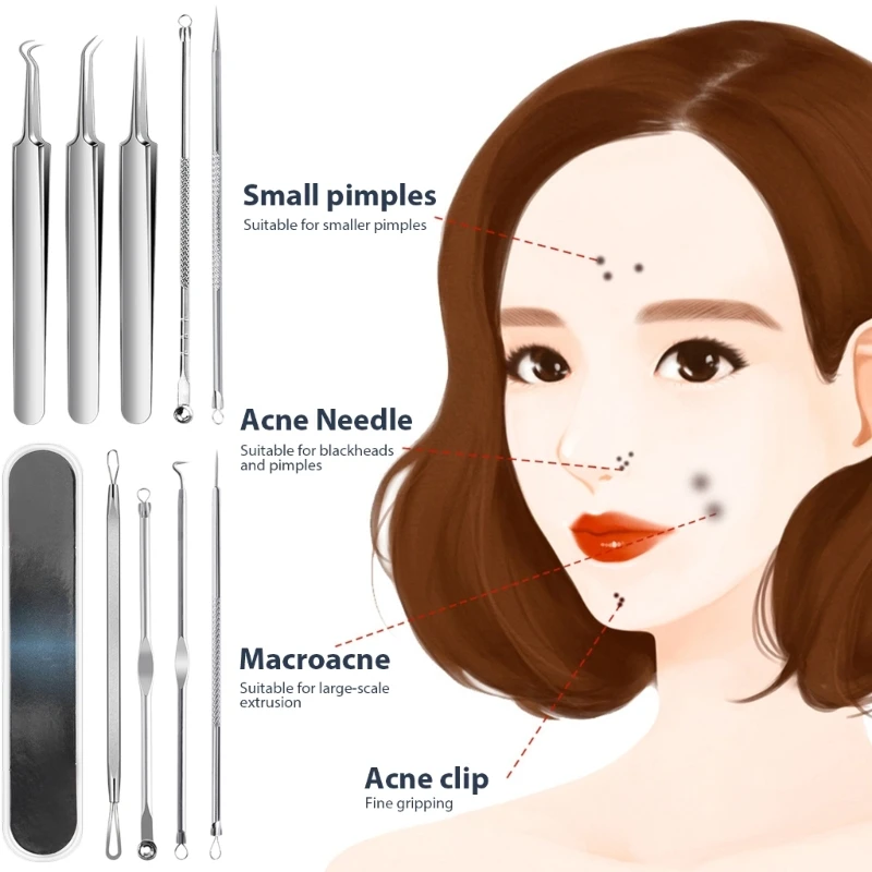 9 قطعة أداة إزالة الرؤوس السوداء الفولاذ المقاوم للصدأ مجموعة أدوات بثرة إزالة الرؤوس السوداء دروبشيبينغ