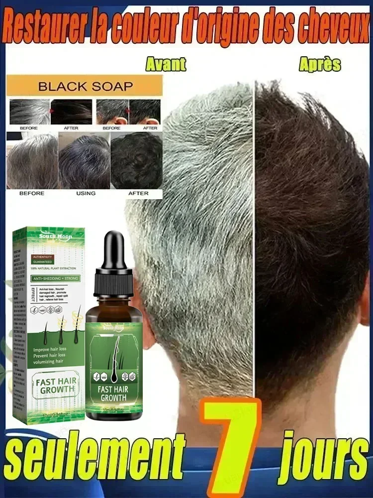 Turn white hair into black hair, remove gray hair in 7 days and restore natural and healthy hair color