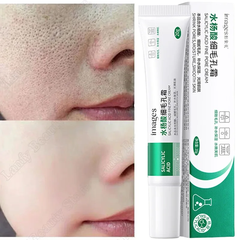 Crema limpiadora de poros de ácido salicílico, reduce los poros, elimina puntos negros, acné, ilumina, hidratante, suave, cuidado de la piel, productos coreanos