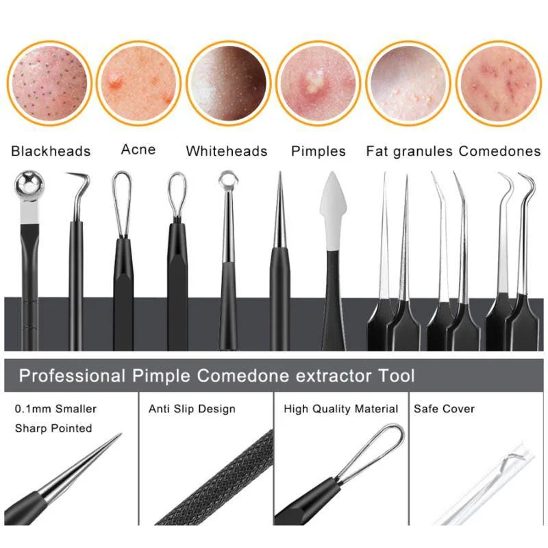 Kit d'outils professionnels Pimple Popper, extracteur de points noirs avec boîtier en métal, retrait facile pour Zit Remoimplemen Front, Antarctique, 10 pièces