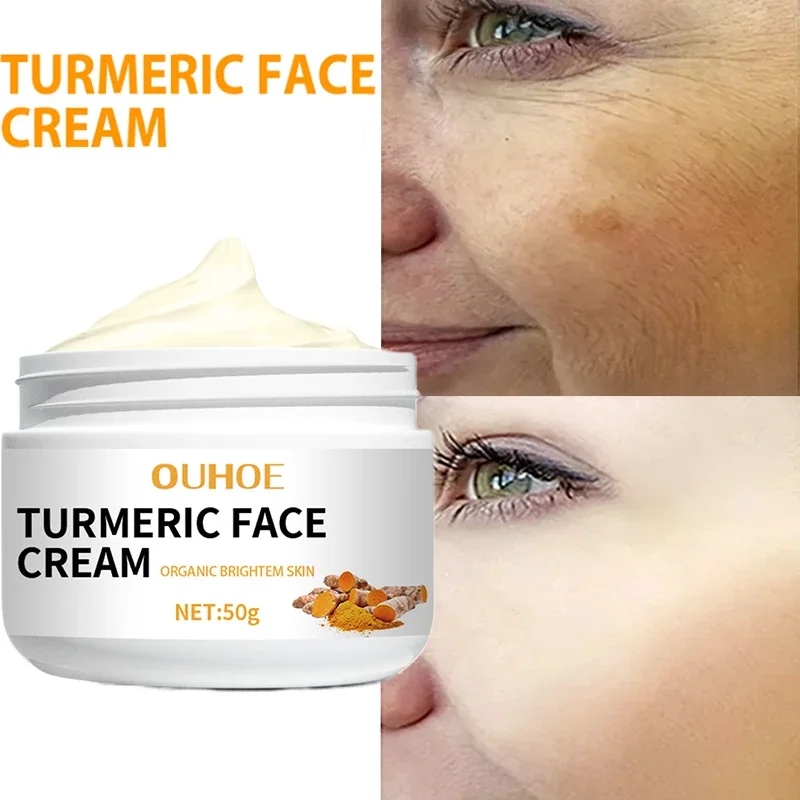 

Turmeric Face Cream Anti-Aging Moisturizing Smooth Fine Lines Face Blemish Freckle Melasma Remove Whitening Firming Skin Care50g