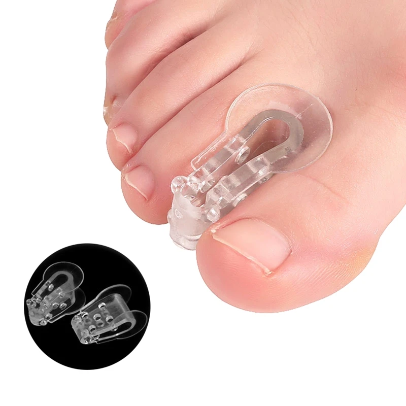 2 szt. Silikonowe artykuły ortopedyczne na palce korektor haluksów palucha koślawego do pedicure