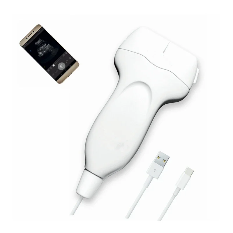 

high resolution touch screen USB ultrasound probe portable Black and White ultrasound