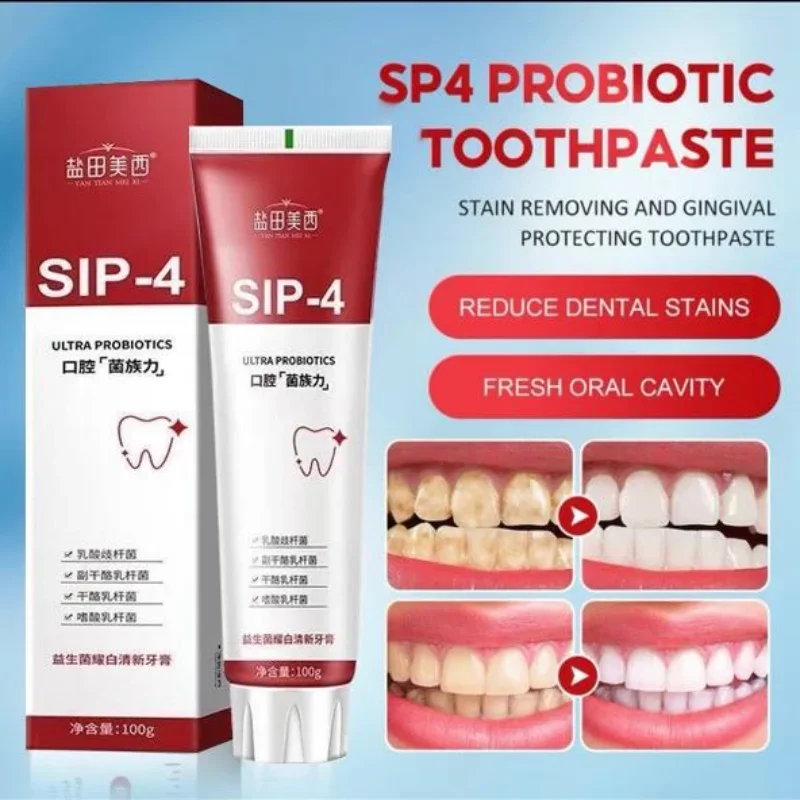 Probiótico creme dental SP-4 branqueamento dente remover manchas de placa branqueador de dentes higiene oral limpo respiração fresca ferramentas dentárias 120g