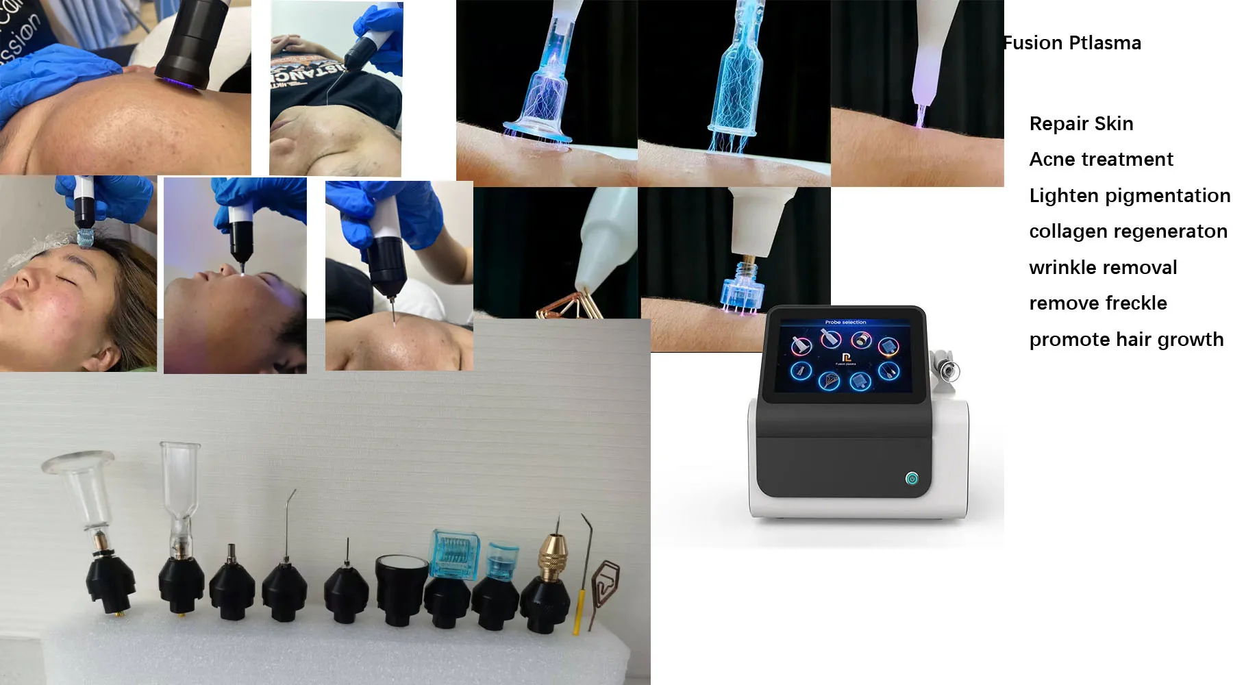 เครื่องพลาสม่า Fusional 8 เครื่องพลาสม่าเย็น อุปกรณ์บํารุงผิวหน้า พลาสม่าเย็น Onychomykose โค้งเย็น