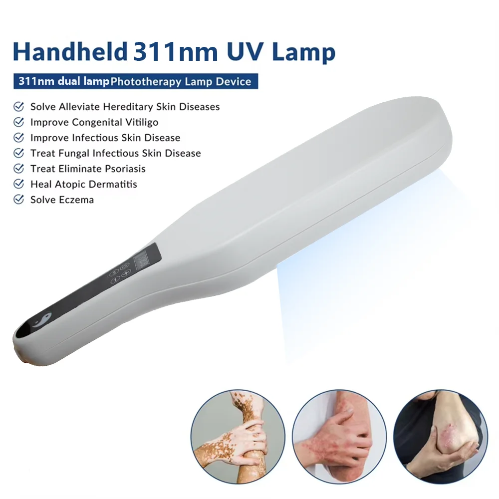 El dispositivo de fototerapia ultravioleta UV de 311 nm utiliza lámpara Philips UVB para tratar vitíligo, psoriasis, manchas blancas y enfermedades de la piel