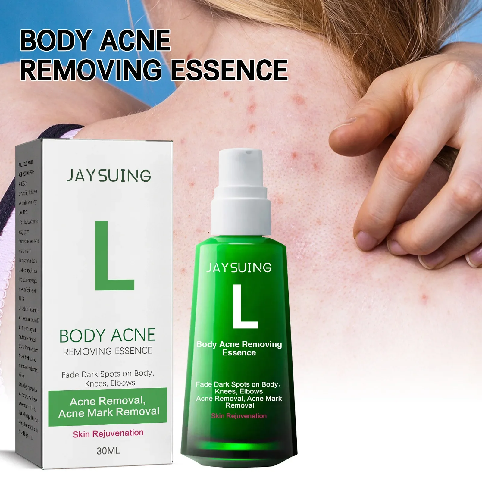 Acne Removing&Whitening essence to fade acne spots, acne marks, moisturize and whiten skin essence