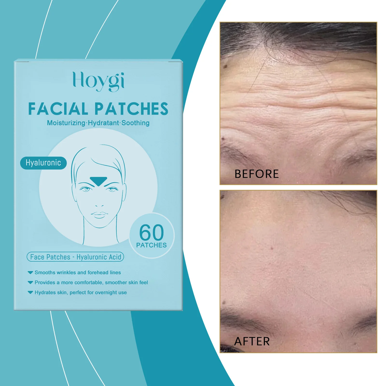 Hyaluronic Acid Facial Patches - 60 Pcs Moisturizing Face Patches, Smooth Wrinkles & Forehead Lines, Overnight Hydrating