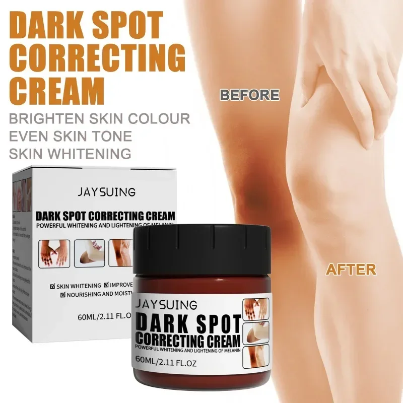 

Sdotter Join remove Dark Spot clean Cream Whitening Underarm Knee Inner Thighs Body Lighten Melanin Armpit Bleaching Brighten Sk