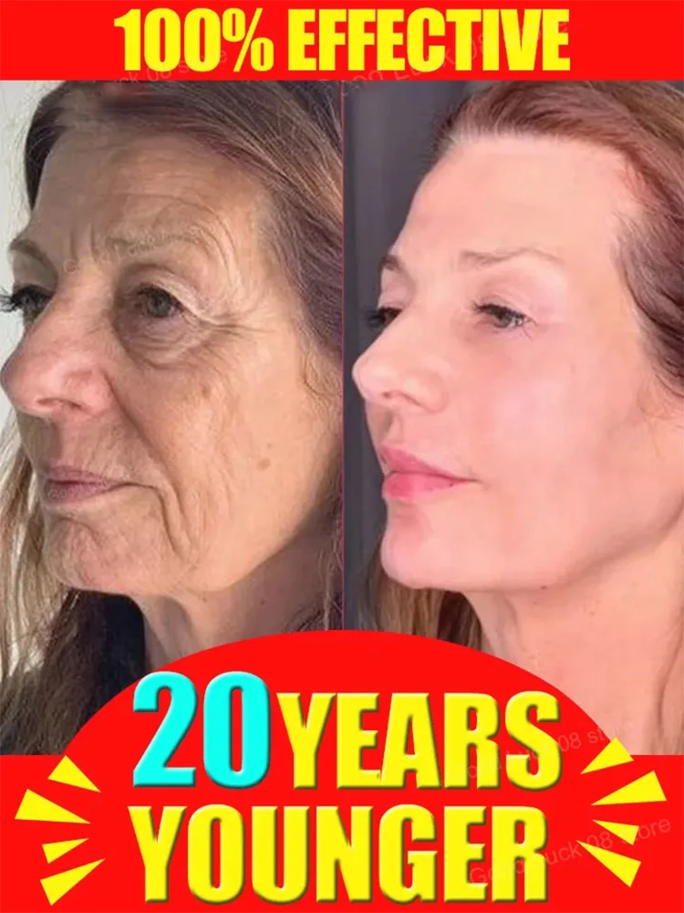 

Крем против морщин Oxys, старение, лифтинг лица, удаление морщин, уход за кожей, Coreanos, белый профессиональный уход, ало-массажеры, лифтинг красоты-здоровья