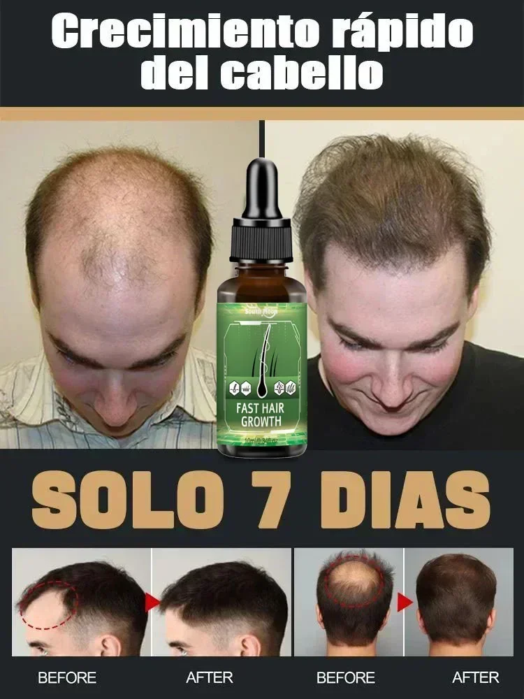 99% of buyers buy again, have more and more hair, say goodbye to baldness, thick hair,Hot selling product