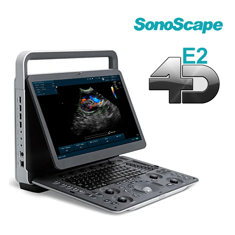 Medical Portable Sonoscape E2 3D 4d Digital Color Doppler OB/GYN Ultrasound machine