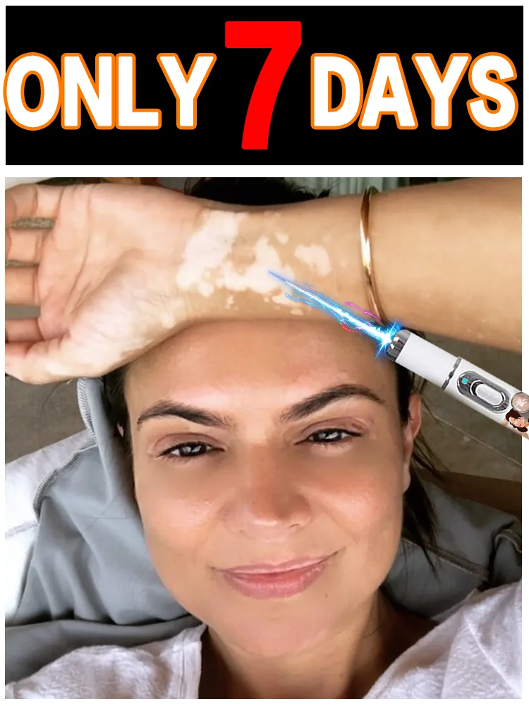 

Essential for daily care of vitiligo symptoms! Blue set, vitiligo treatment fast