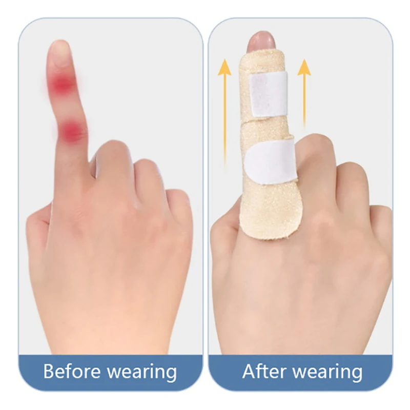 Pain Relief Finger Splint Fracture Protection Brace Adjustable Sprain Dislocation Fracture Finger Splint Corrector Support
