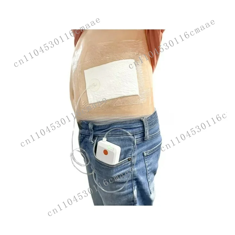 Factory Wholesale Portable NPWT Pump, Negative Pressure Wound Therapy System, Vacuum Wound Care Device With Complete Dressing Ki