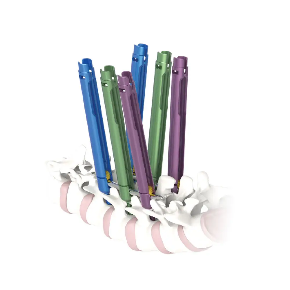 Titanium Alloy Interspinous Spacer Fixation System Rod Minimally Invasive Rod Model 7100