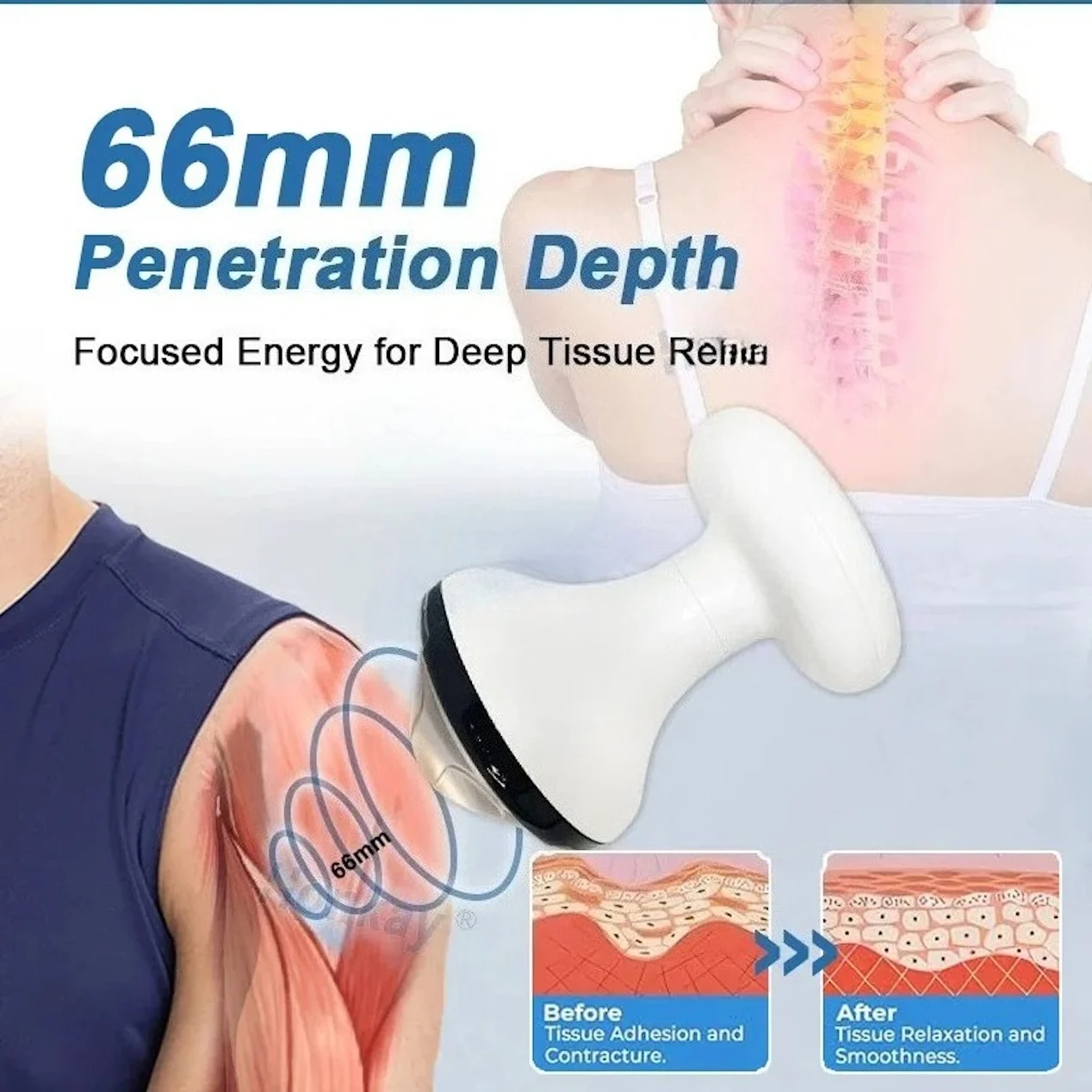 Handle for Focus Shockwave Device Replace Handle Part for FSWT Focused Shock Wave Therapy Machine Body Pain Relief