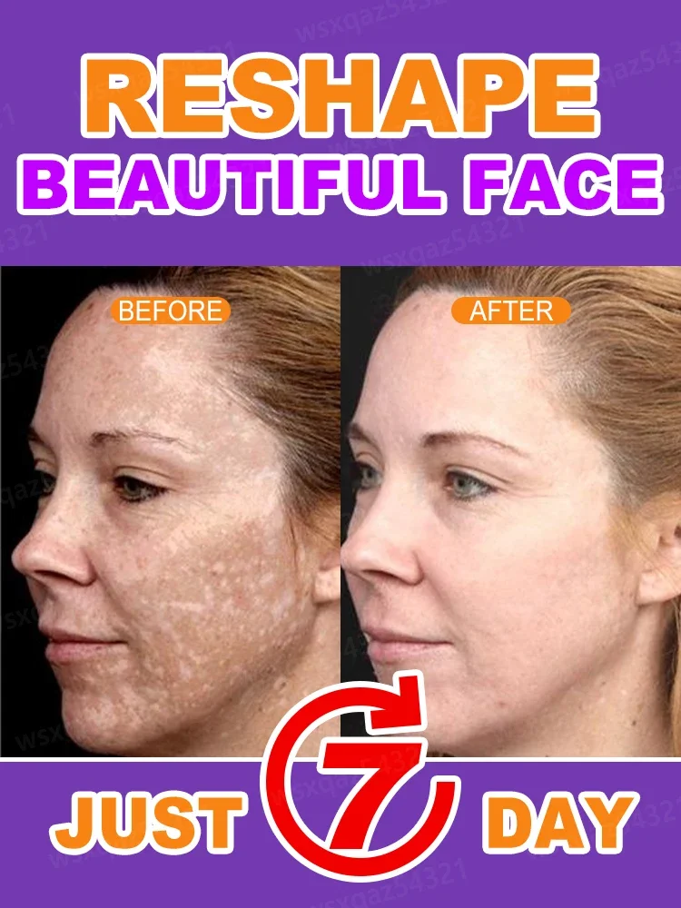 Solve various facial problems, brighten skin tone, and give you flawless white skin