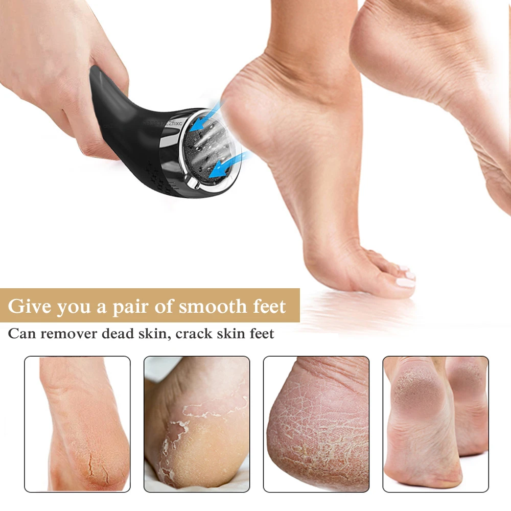 Electric Foot File Callus Remover Professional Feet Pedicure Sander Heel Dead Skin Grinder Rechargeable Foot File Removal Tool