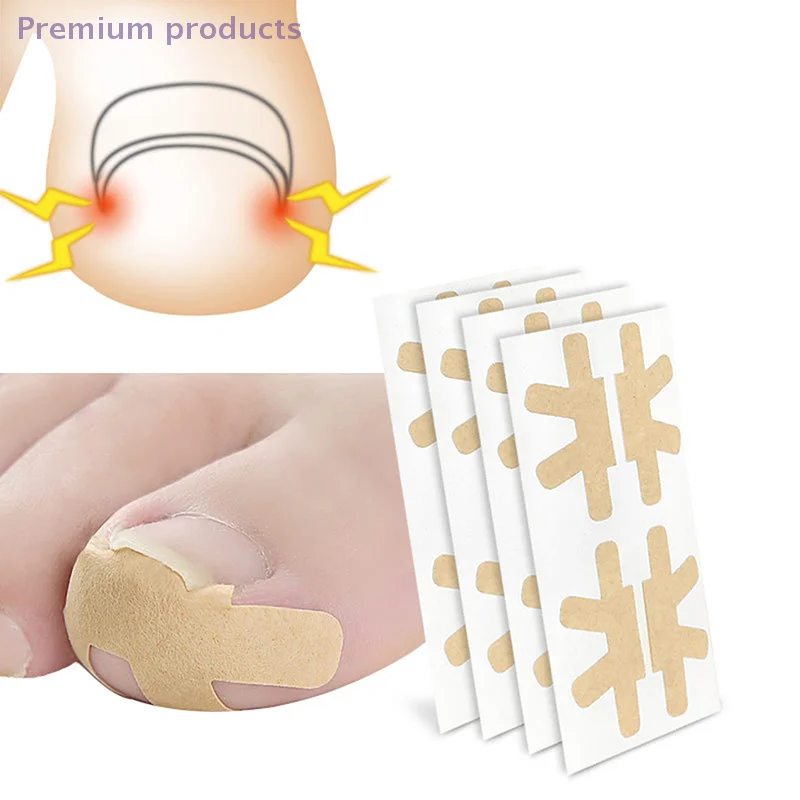 Zhengjia Tie Toenail Fungus Patch Sticky Nail Repair Patch Nail Ingrown Correction Sticker Toenail Care Paronychia Nail Patch