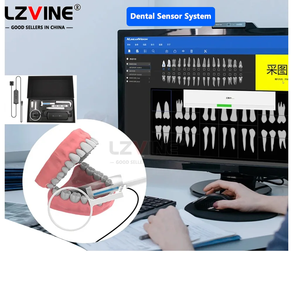 Рисунок 3 - Стоматологический датчик Рентгеновский