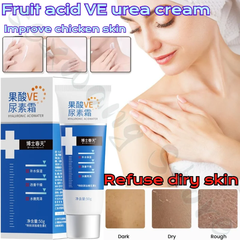 

Fruit Acid VE Urea Cream Improves Chicken Skin Urea Body Milk Hydrating Moisturizing Moisturizing Anti-Dry Cracking 50g