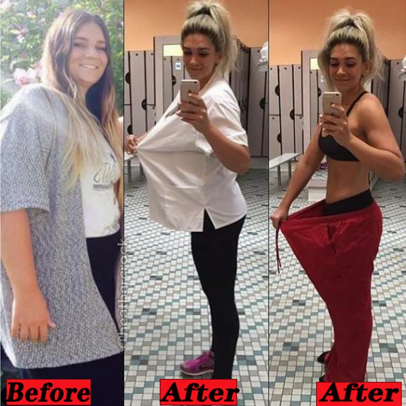 Strongest Fat Burning and Cellulite Slimming Diets p-atch Weight Loss Products Detox Face Lift Decreased Appetite Night Enzyme