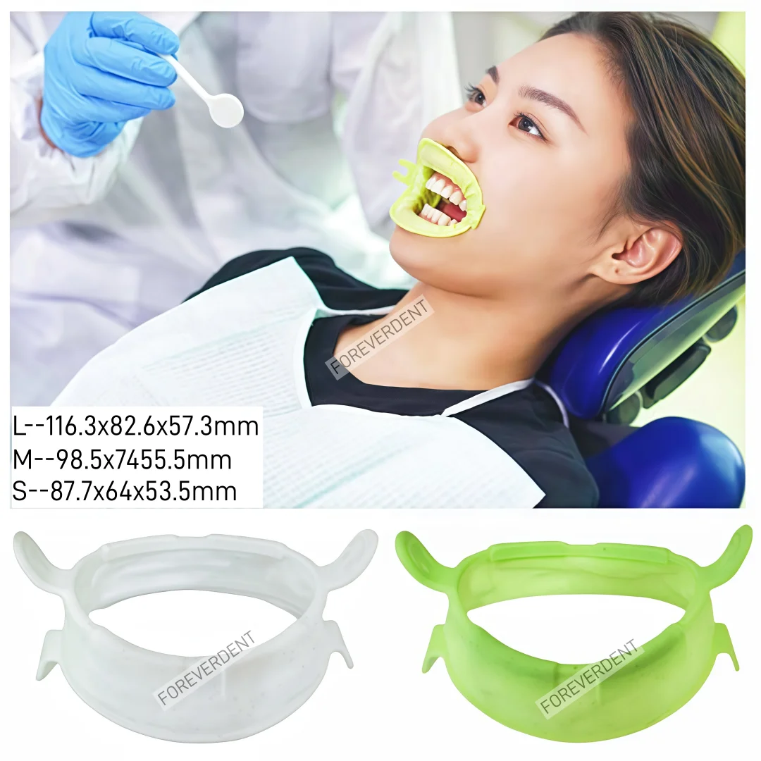 

2-100 шт. ретракторы для дёсен O-образной формы, стоматологические расширители рта, ортодонтические фиксаторы для губ, держатели для слюноотсосов S/M/L