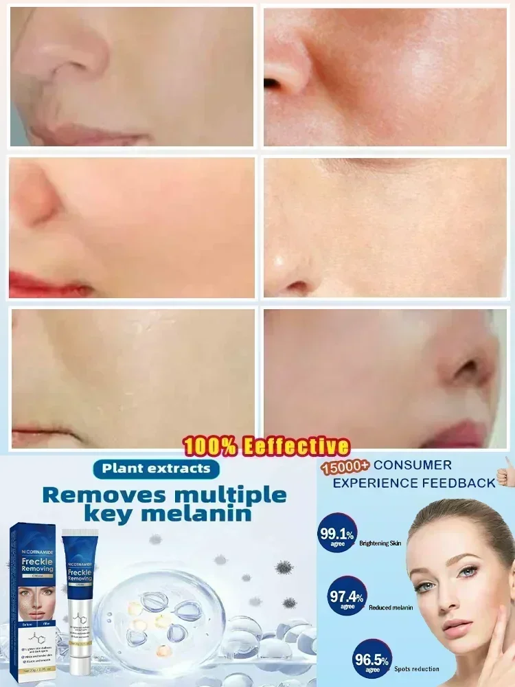 Whitening Anti-Freckle Cream Brighten Skin Tone Remove Freckles Lighten Spots Chloasma Brighten Moisturize Face Skin Care