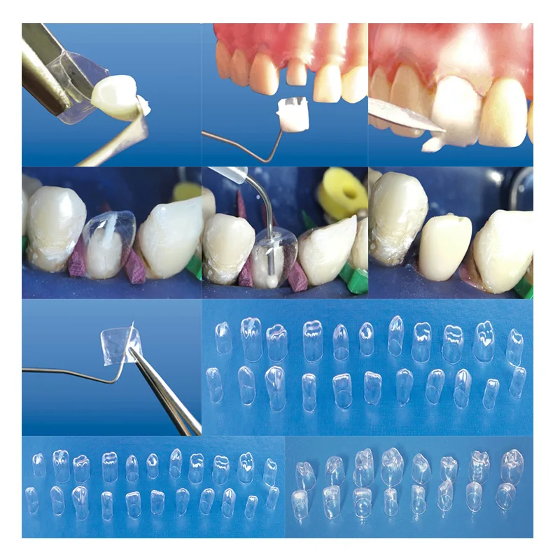 Stożkowe przezroczyste korony dentystyczne 64 sztuk/pudło zęby dziecka korony liściaste przednie narzędzia dentystyczne wybielanie zębów matrycy