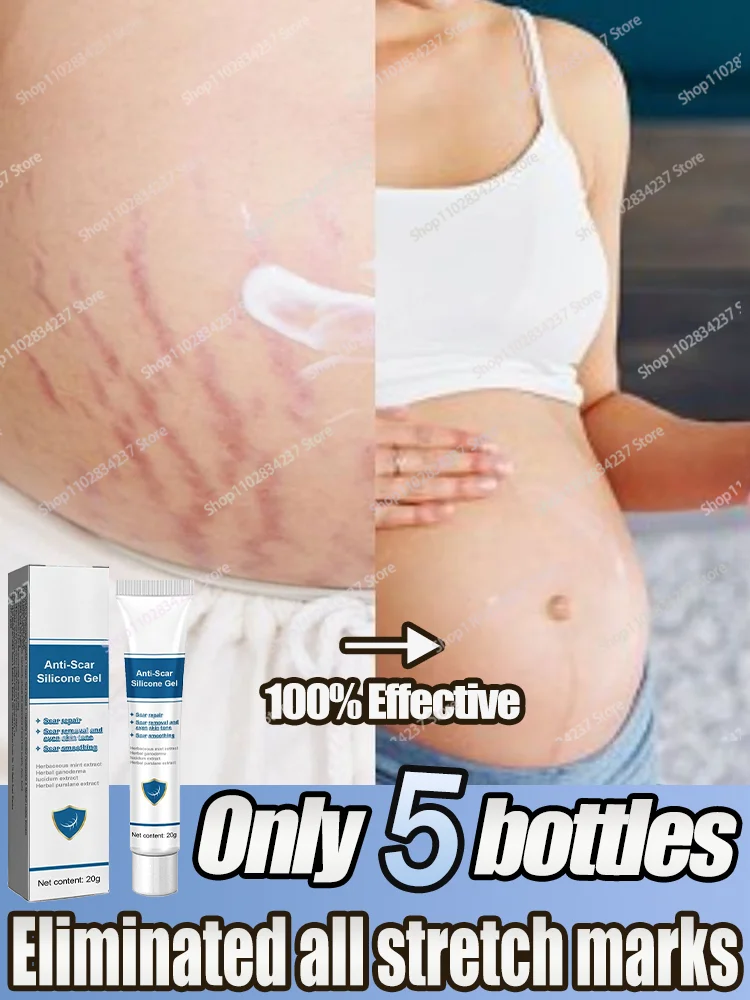 Pregnant Women Postpartum Repair Stretch Marks Scars Fade New