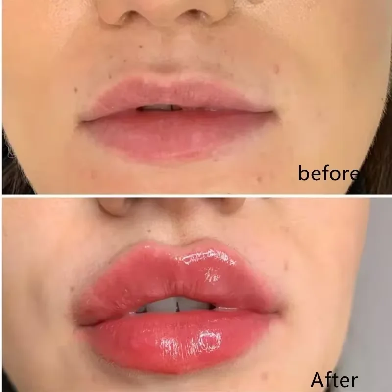 Lip Booster Plumping Serum Oil Hyaluronate Moisturizing Sexy Plump Products Enhancer Non-Irritating Brighten Fade Lines Care