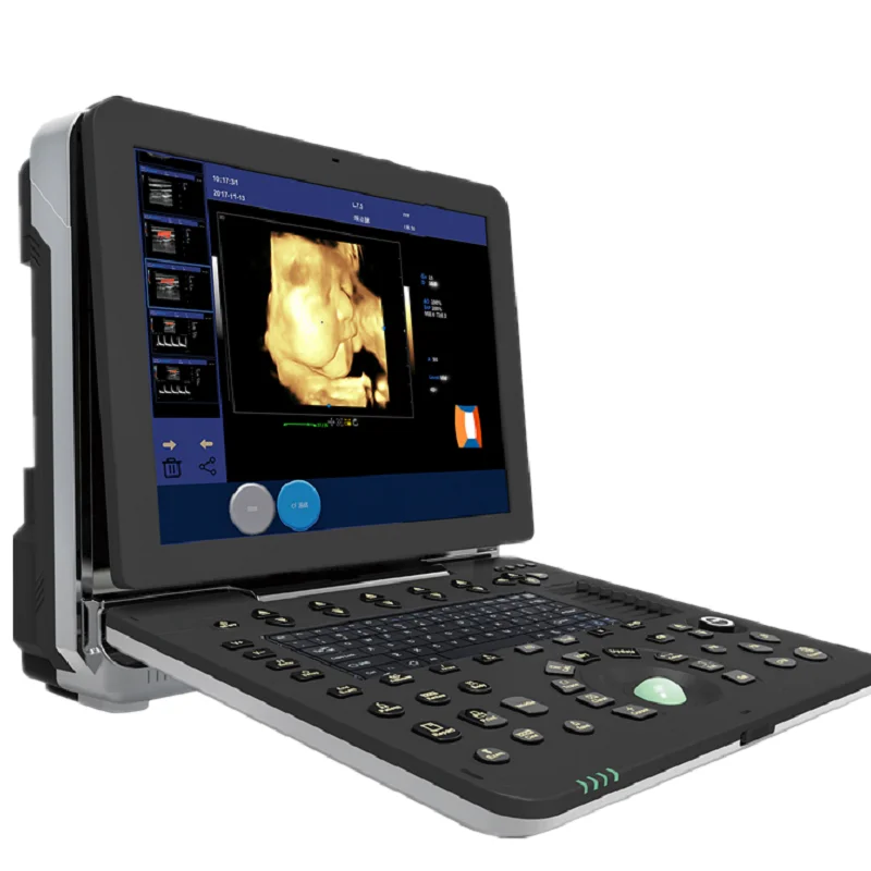 Hospital Equipment Laptop 4D Color Doppler Vascular Cardiac Portable Ultrasound Scanner High End Model