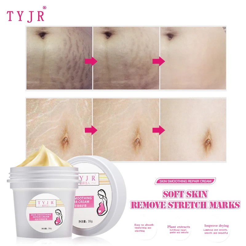 35G Effectively Repair Stretch Marks Removal Remover Plant Natural Heal Pregnancy Breast Hip Legs Stretch Mark Cream