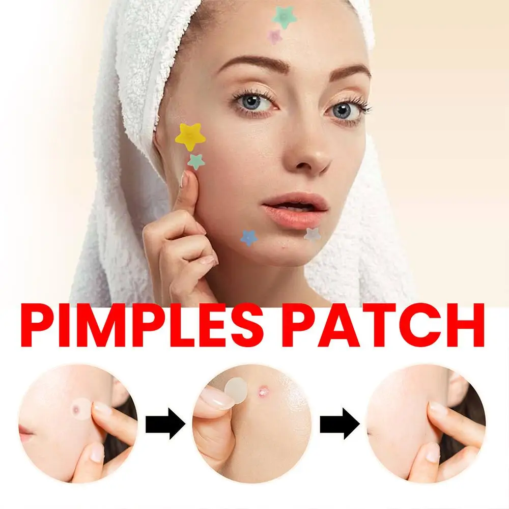 Cute Star Acne Removing Patch, Máscara de acne, Patch invisível, Remoção de manchas faciais, Pimple Sticker, Colorido, 200 Pcs