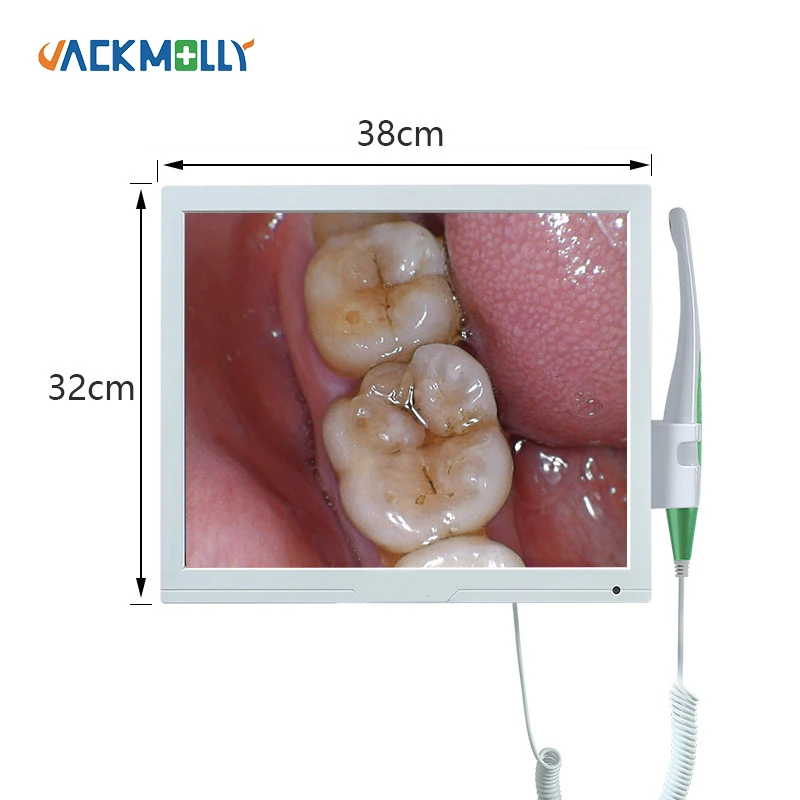 Câmera Intraoral com Wi-Fi, Câmera Intraoral com TV Type Scanner, Grau Médico