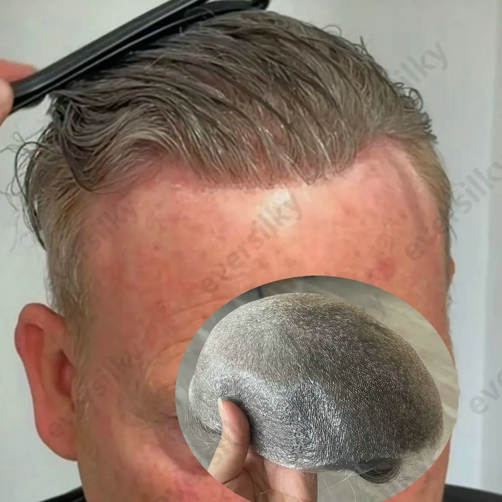 Natürliches 90-Dichte, unsichtbares 0,02 mm dünnes Skin-Basis-Toupet mit super-natürlichem Haaransatz für Männer, Echthaar-System, Kapillarprothese – Detail 1