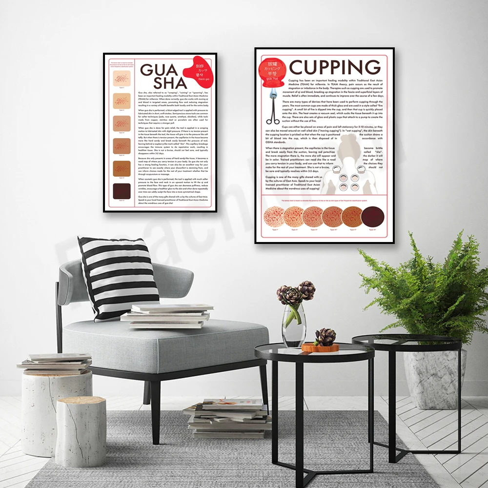 Cupping Poster, Gua Sha Poster Healthy Body Massage Spa Beauty Salon Wall Art Canvas Poster Picture HD Painting Home Decoration